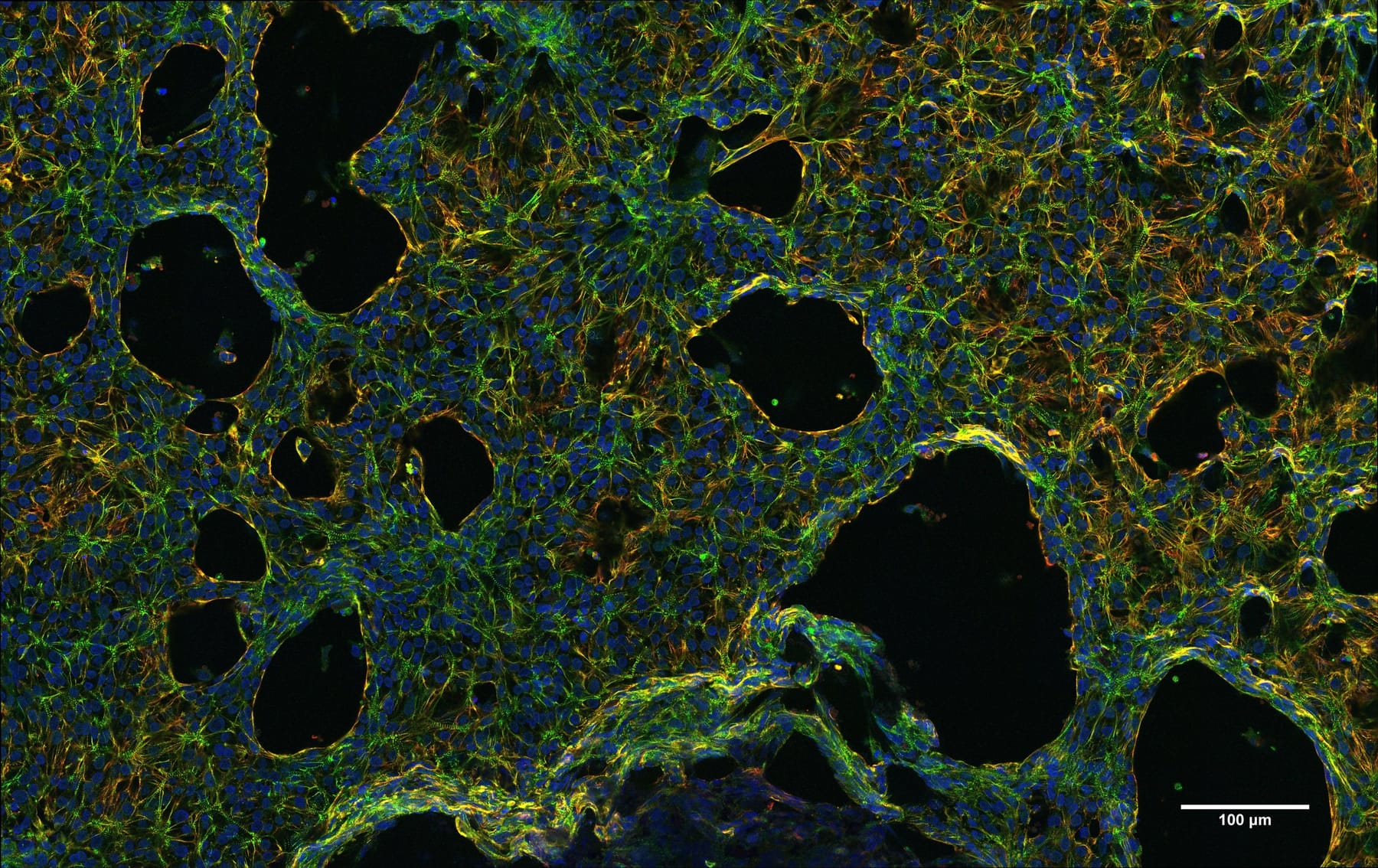 Single CM TileScan — merged with scale