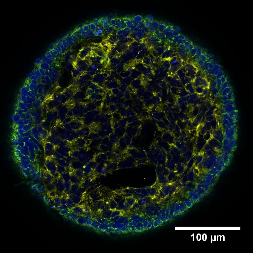 Wide microscopy overview — merged