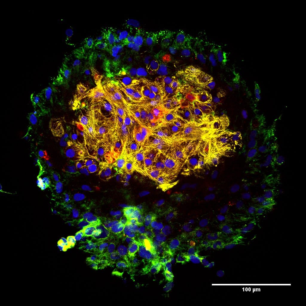 Ring organoid — merged