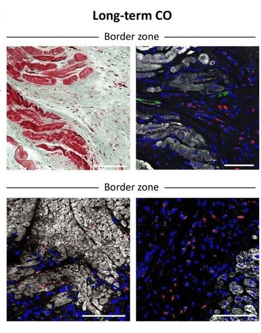Border zone — histology